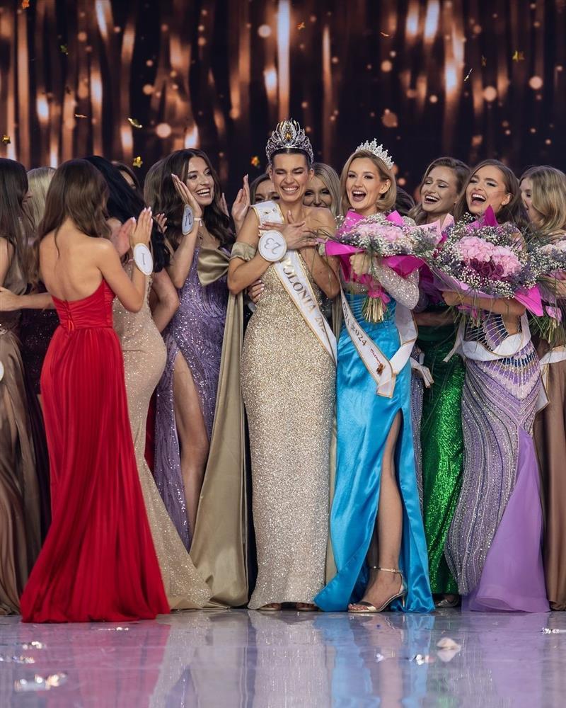 Top 3 Hoa hậu Ba Lan bị chê già như trung niên